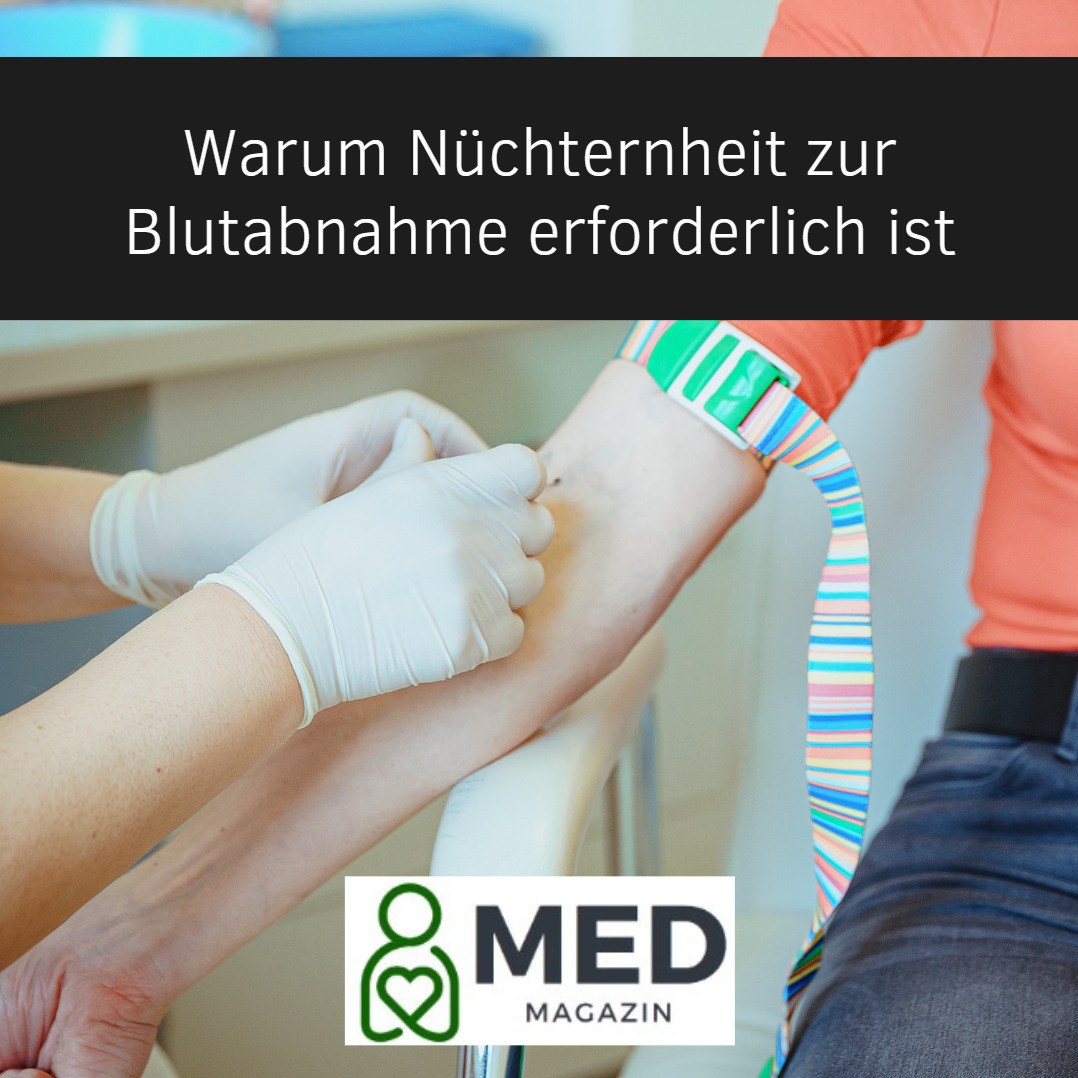 Blutabnahme nüchtern