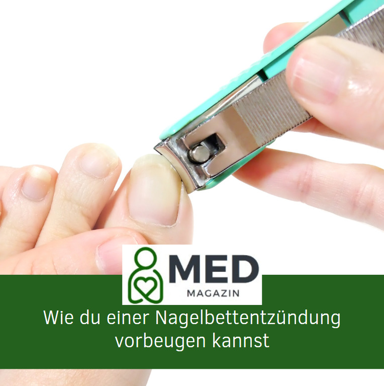 Wie du einer Nagelbettentzündung vorbeugen kannst
