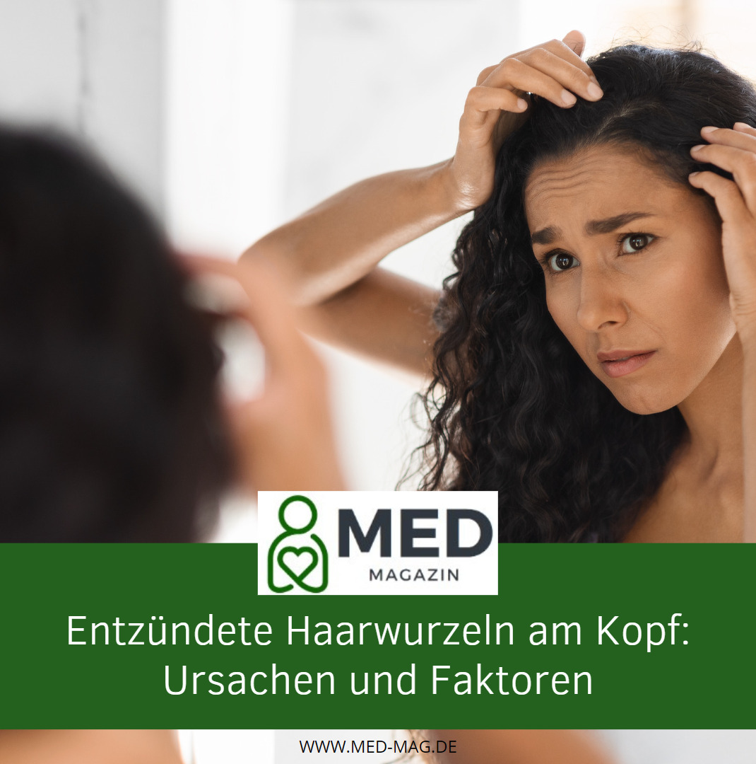 Entzündete Haarwurzeln am Kopf Ursachen und Faktoren