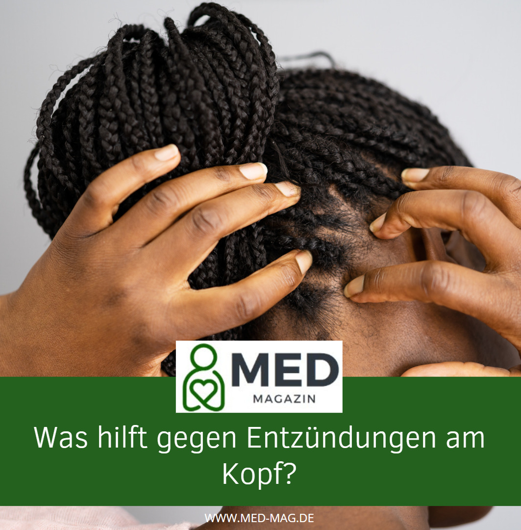 Was hilft gegen Entzündungen am Kopf