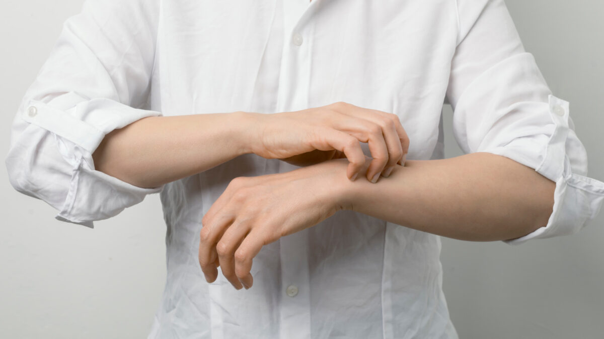 Wie behandle ich Krätze: Hausmittel Gegen Symptome und Ansteckung
