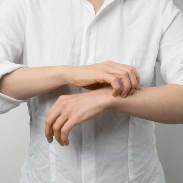 Geplatzte Ader im Auge: Symptome | Hyposphagma