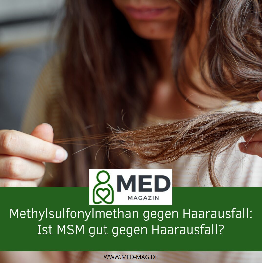 Methylsulfonylmethan gegen Haarausfall Ist MSM gut Gegen Haarausfall