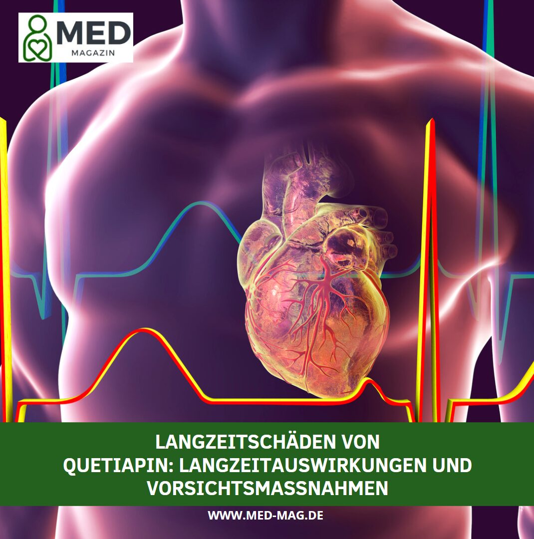 lanzeitschäden von quetiapin