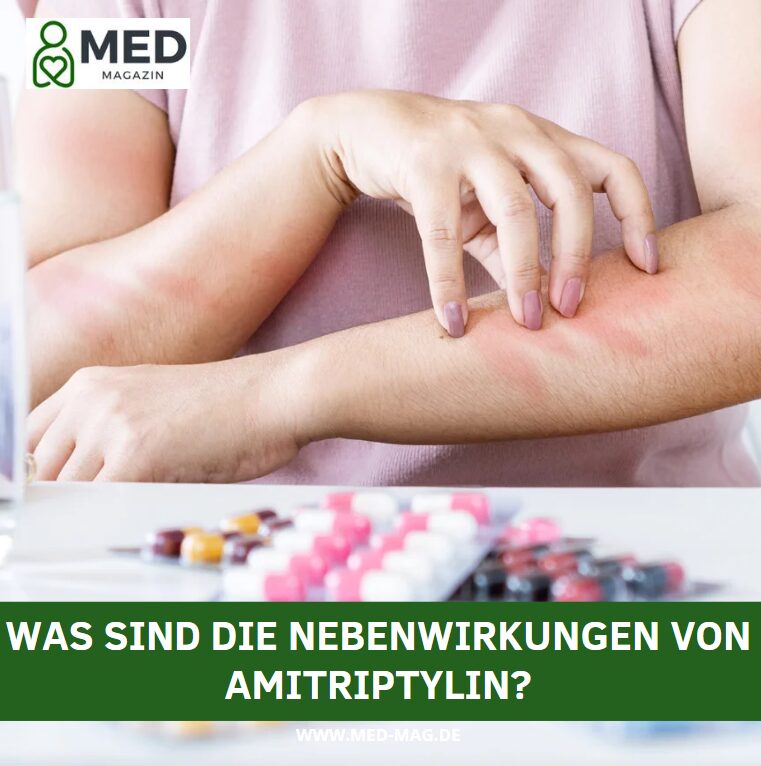 Teufelszeug Amitriptylin: Was sind die Nebenwirkungen von Amitriptylin?