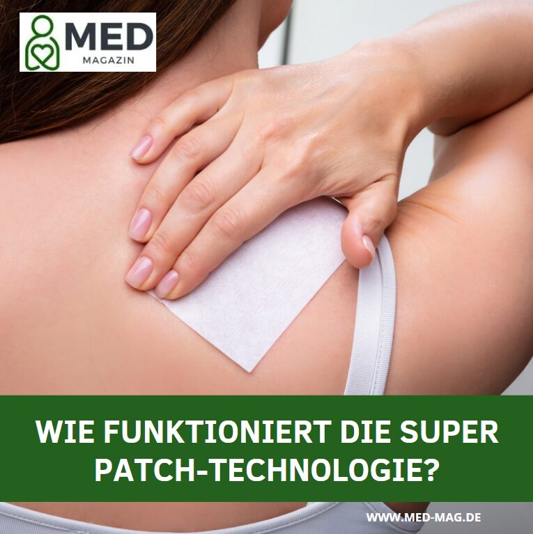 Wie funktioniert die Super Patch-Technologie? Wie funktioniert die Super Patch-Technologie?