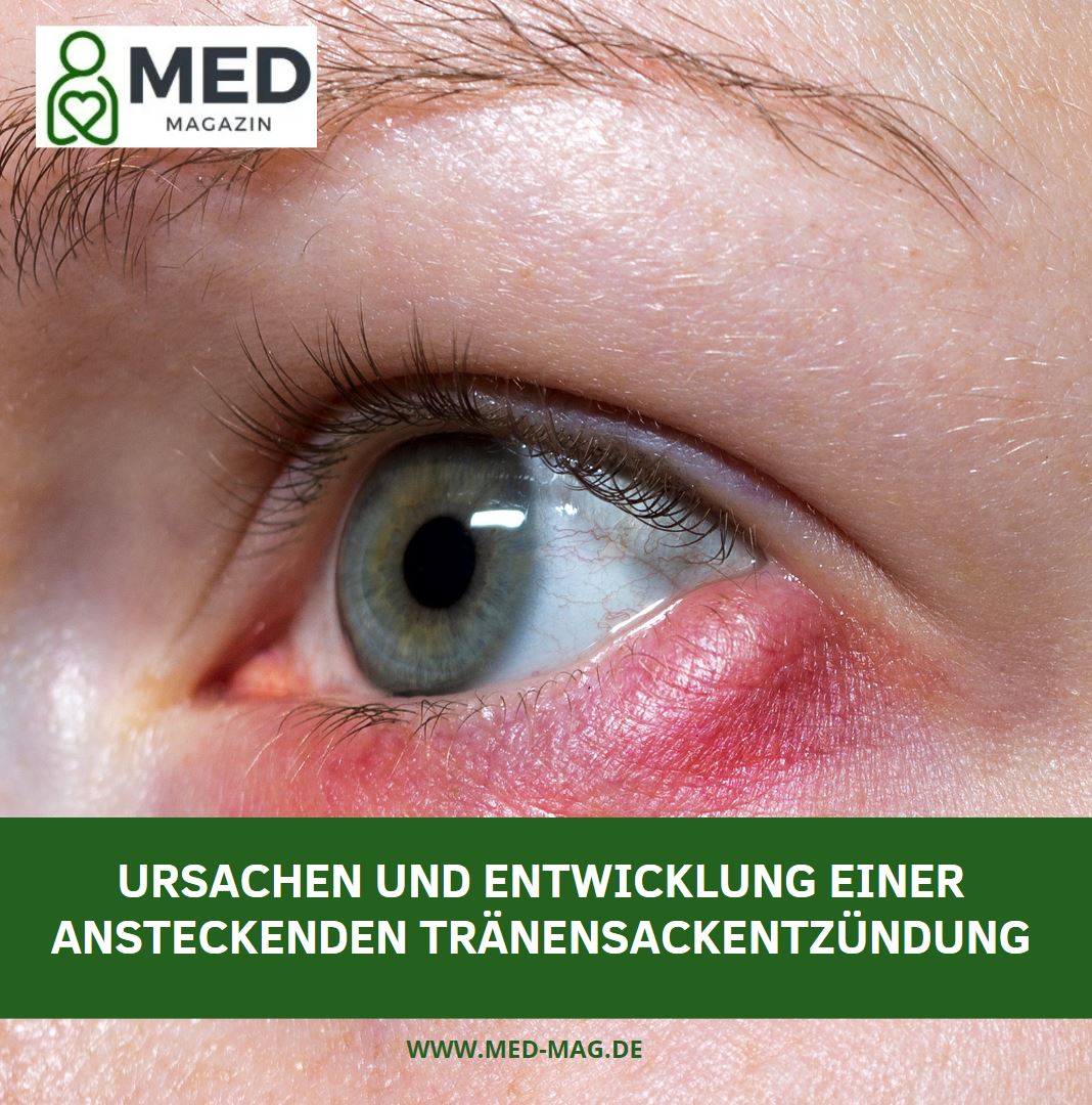 Ursachen und Entwicklung einer ansteckenden Tränensackentzündung