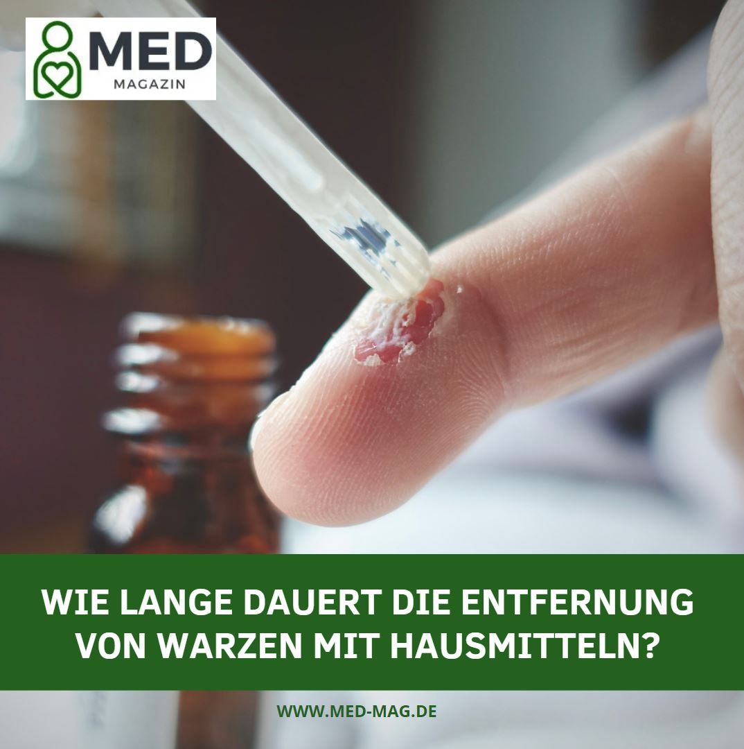 Wie lange dauert die Entfernung von Warzen mit Hausmitteln Wie lange dauert die Entfernung von Warzen mit Hausmitteln