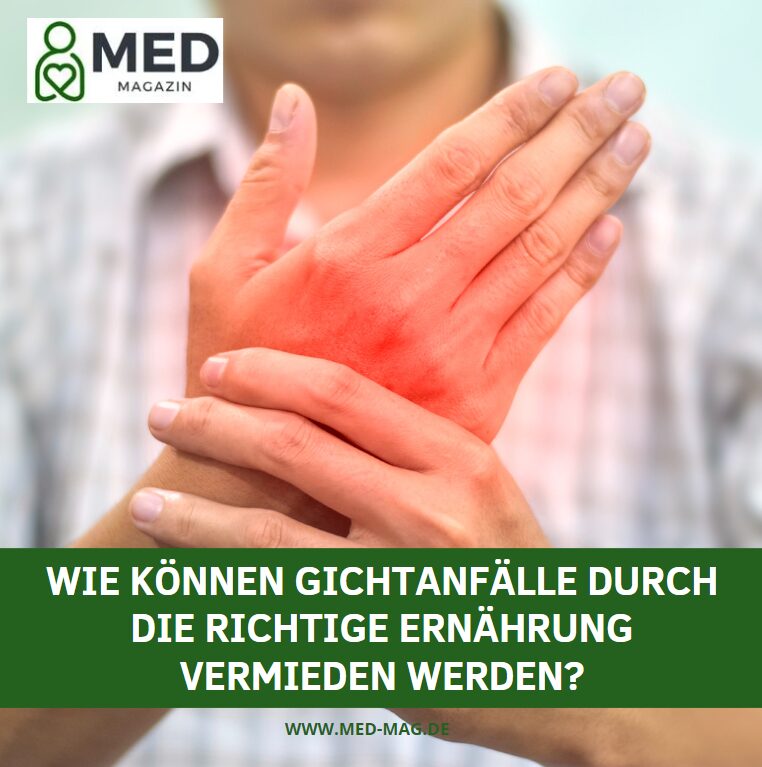 Wie können Gichtanfälle durch die richtige Ernährung vermieden werden? Wie können Gichtanfälle durch die richtige Ernährung vermieden werden?