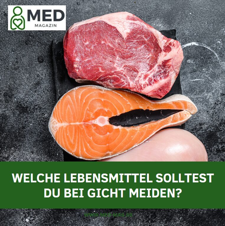 Welche Lebensmittel solltest du bei Gicht meiden? Welche Lebensmittel solltest du bei Gicht meiden?