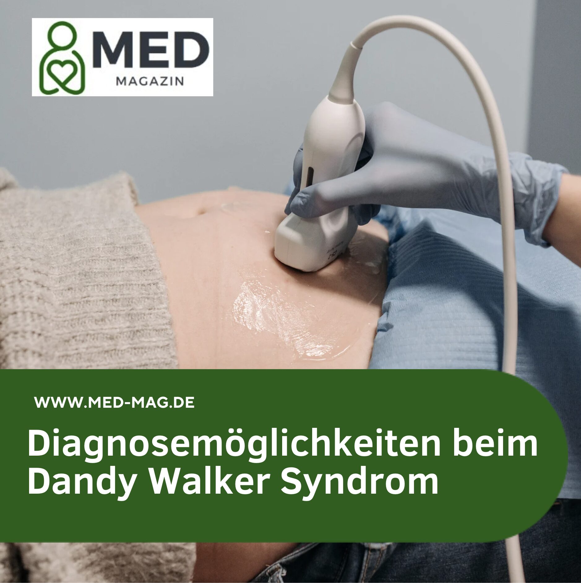 Diagnosemöglichkeiten beim Dandy Walker Syndrom