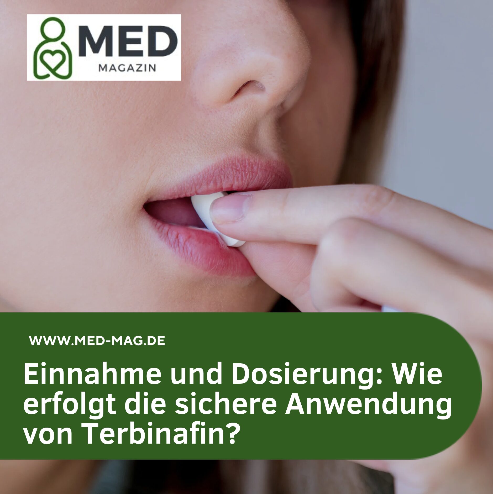 Einnahme und Dosierung: Wie erfolgt die sichere Anwendung von Terbinafin? Einnahme und Dosierung: Wie erfolgt die sichere Anwendung von Terbinafin?