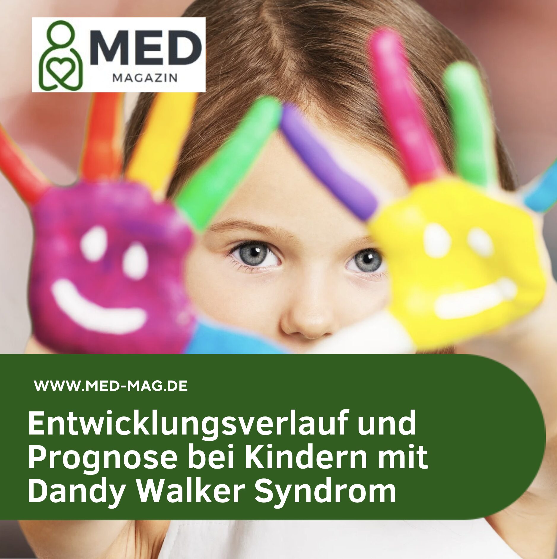 Entwicklungsverlauf und Prognose bei Kindern mit Dandy Walker Syndrom