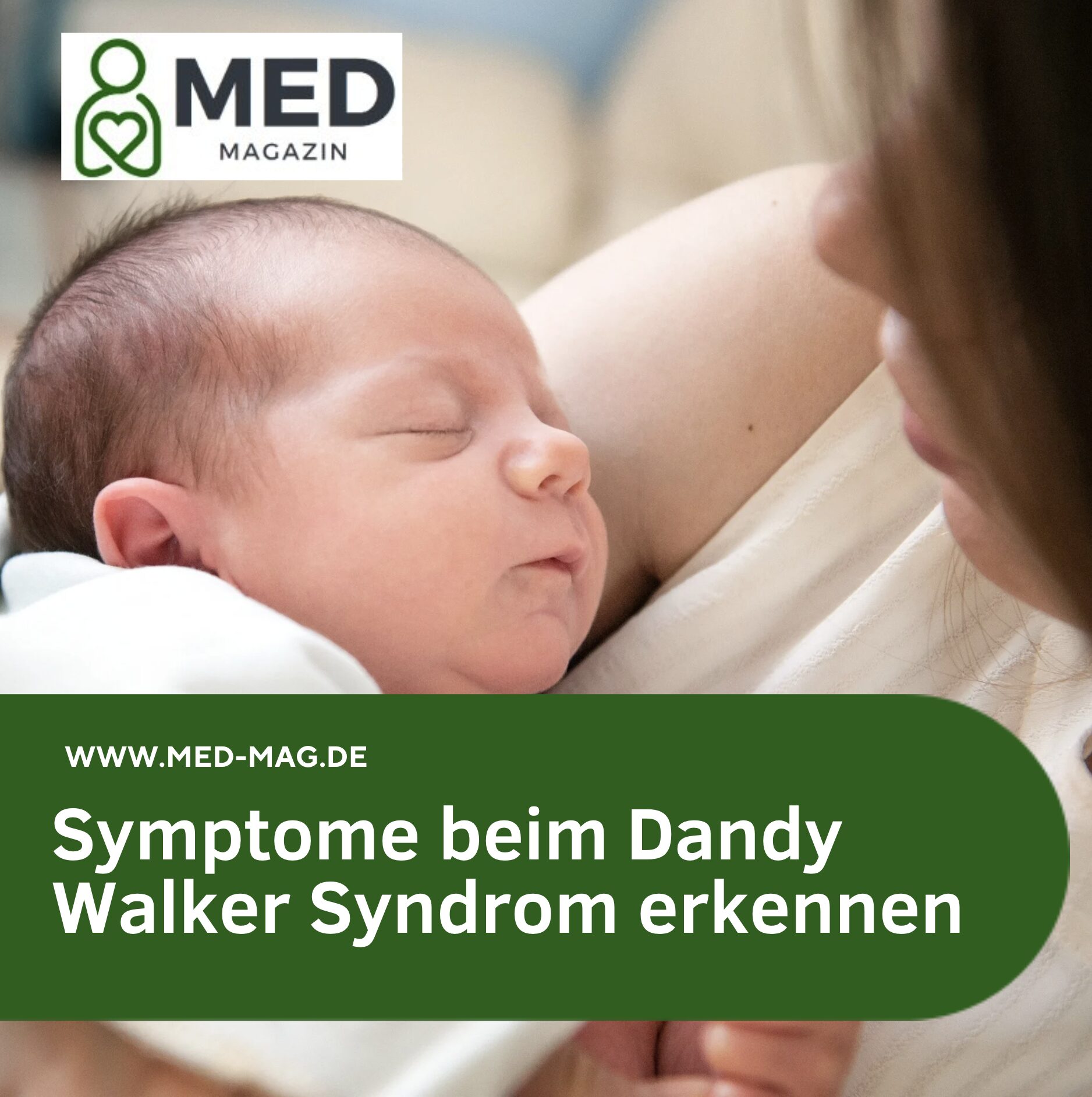 Symptome beim Dandy Walker Syndrom erkennen