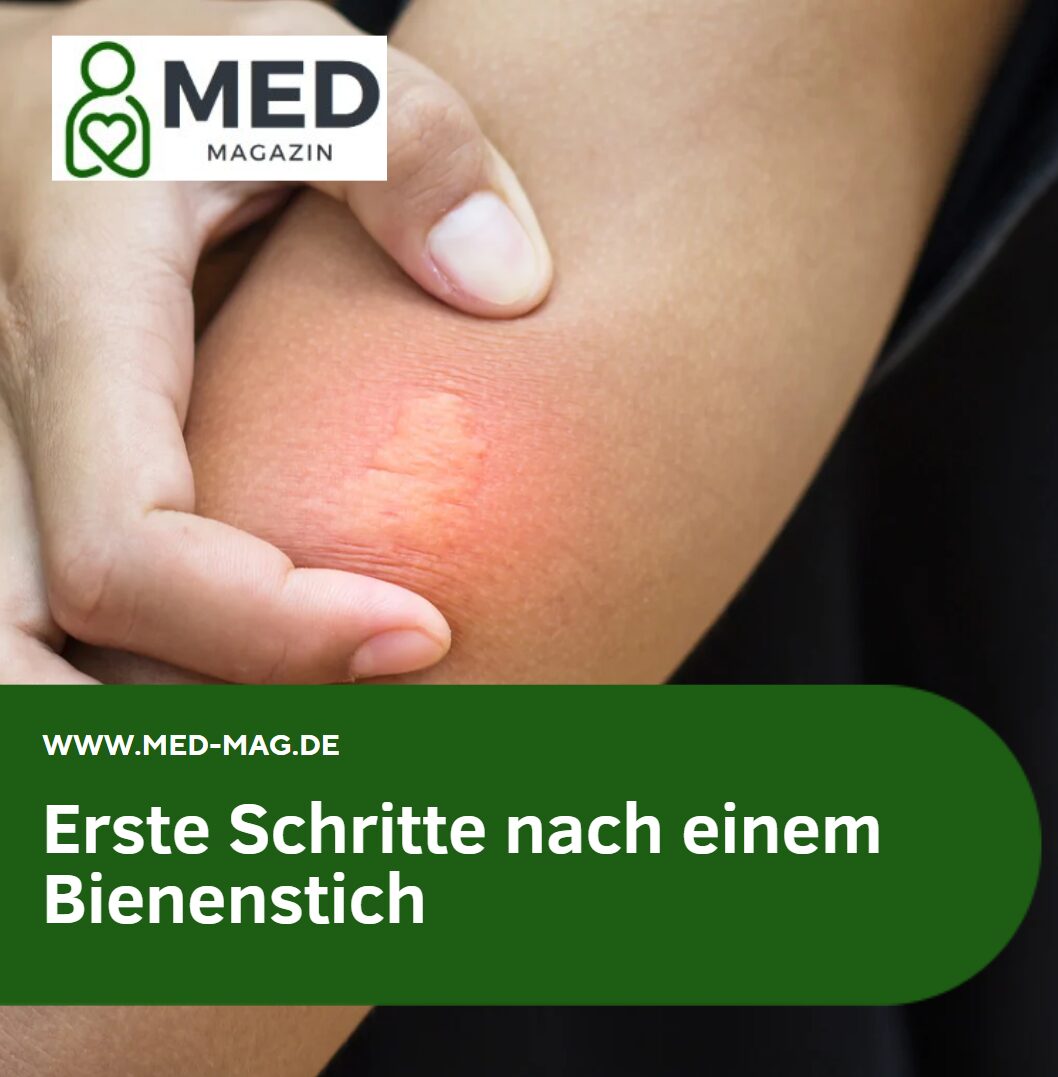 Bienenstich was tun Erste Schritte nach einem Bienenstich Bienenstich was tun Erste Schritte nach einem Bienenstich
