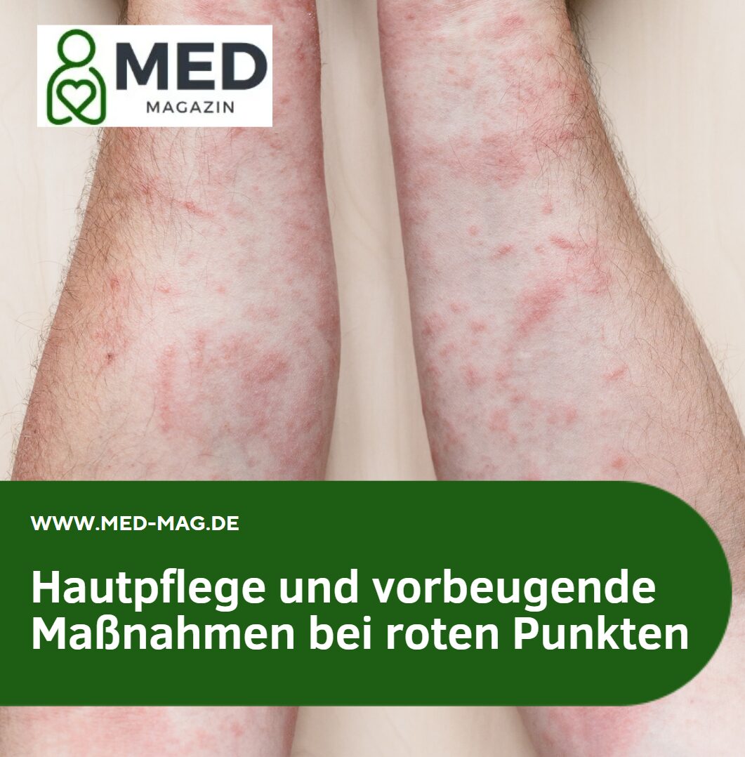 Hautpflege und vorbeugende Maßnahmen bei roten Punkten