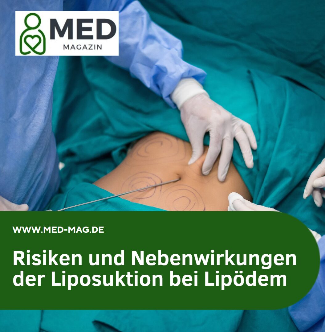 Risiken und Nebenwirkungen der Liposuktion bei Lipödem