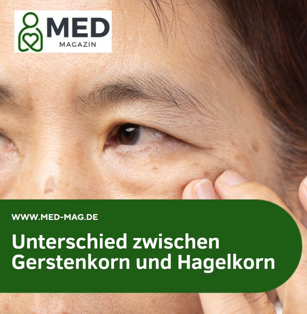 Unterschied zwischen Gerstenkorn und Hagelkorn