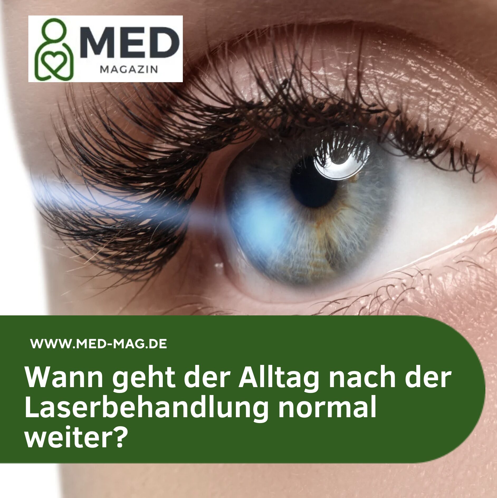 Wann geht der Alltag nach der Laserbehandlung normal weiter?