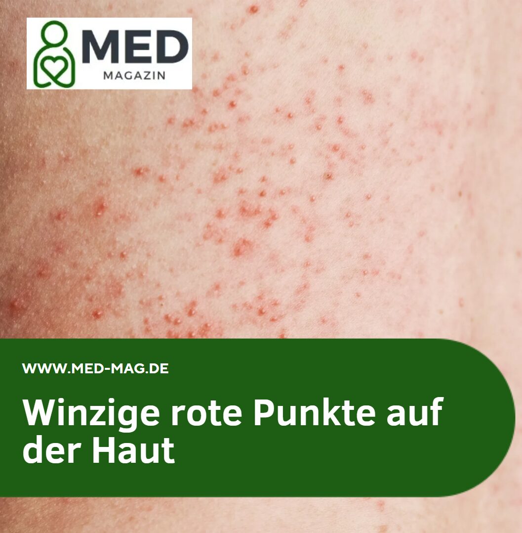 Winzige rote Punkte auf der Haut