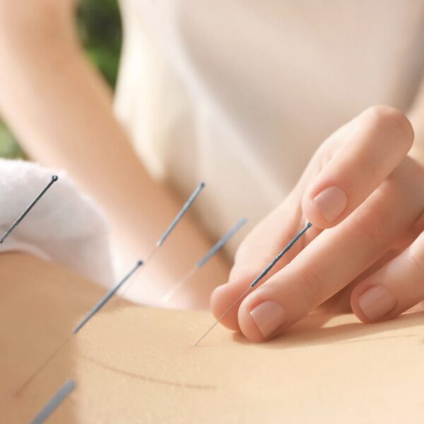 Akupunktur Leber Entgiftung