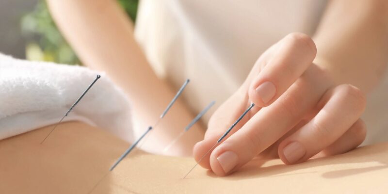 Akupunktur Leber Entgiftung