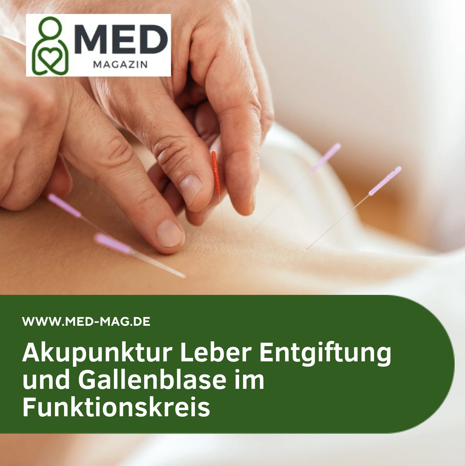 Akupunktur Leber Entgiftung und Gallenblase im Funktionskreis