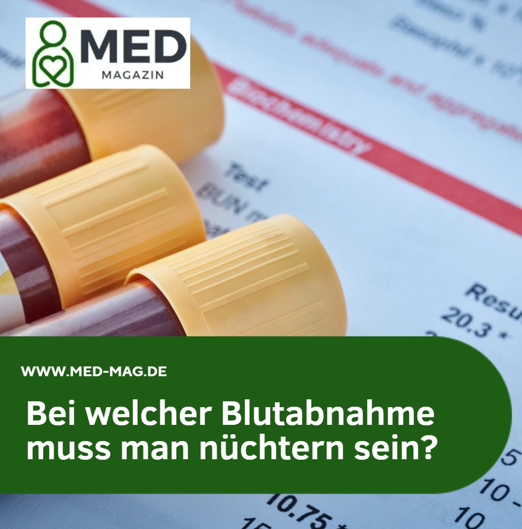 Bei welcher Blutabnahme muss man nüchtern sein