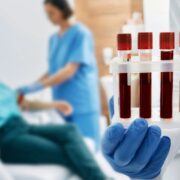 Was bedeutet nüchtern zur Blutabnahme Die wichtigsten Regeln für richtige Laborwerte