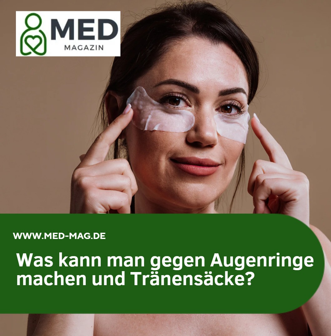 Was kann man gegen Augenringe machen und Tränensäcke Was kann man gegen Augenringe machen und Tränensäcke