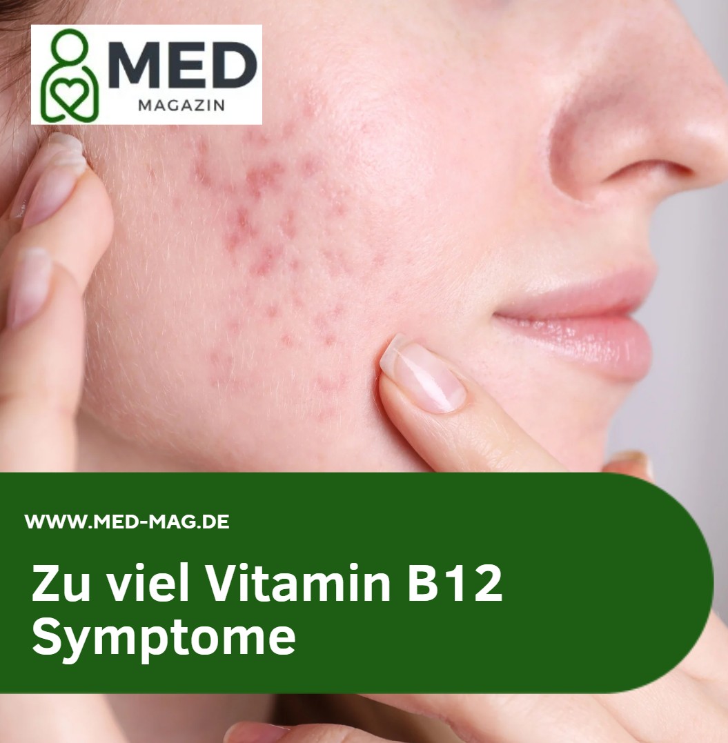 Zu viel Vitamin B12 Symptome Die wichtigsten Anzeichen im Überblick Zu viel Vitamin B12 Symptome Die wichtigsten Anzeichen im Überblick