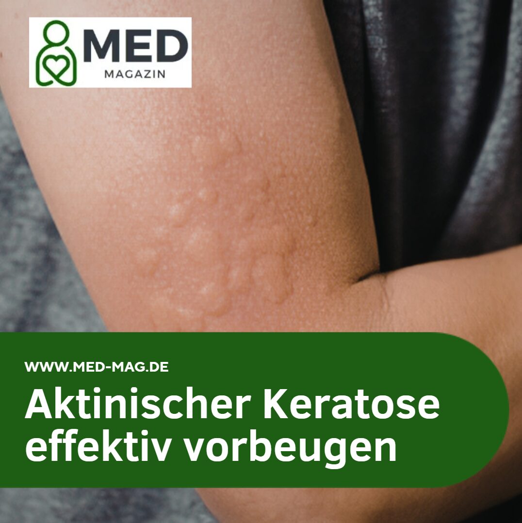 aktinischer keratose vorbeugen aktinischer keratose vorbeugen