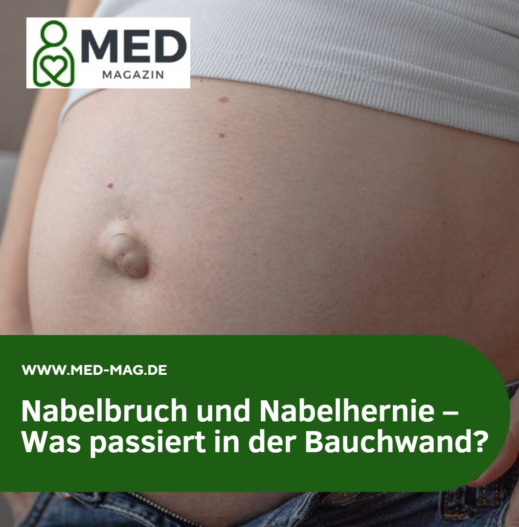 Nabelbruch und Nabelhernie – Was passiert in der Bauchwand Nabelbruch und Nabelhernie – Was passiert in der Bauchwand