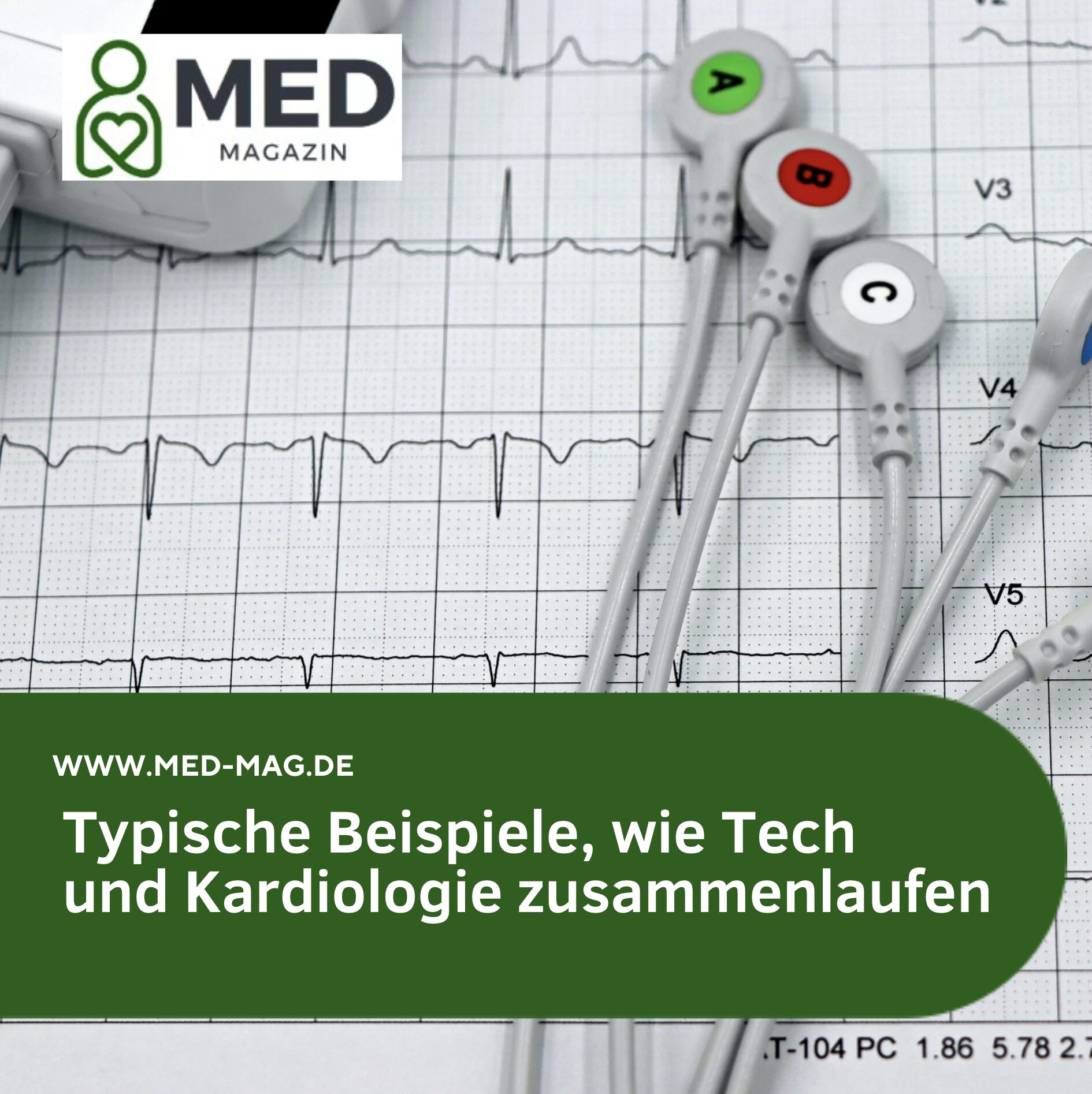 Typische Beispiele, wie Tech und Kardiologie zusammenlaufen Typische Beispiele, wie Tech und Kardiologie zusammenlaufen