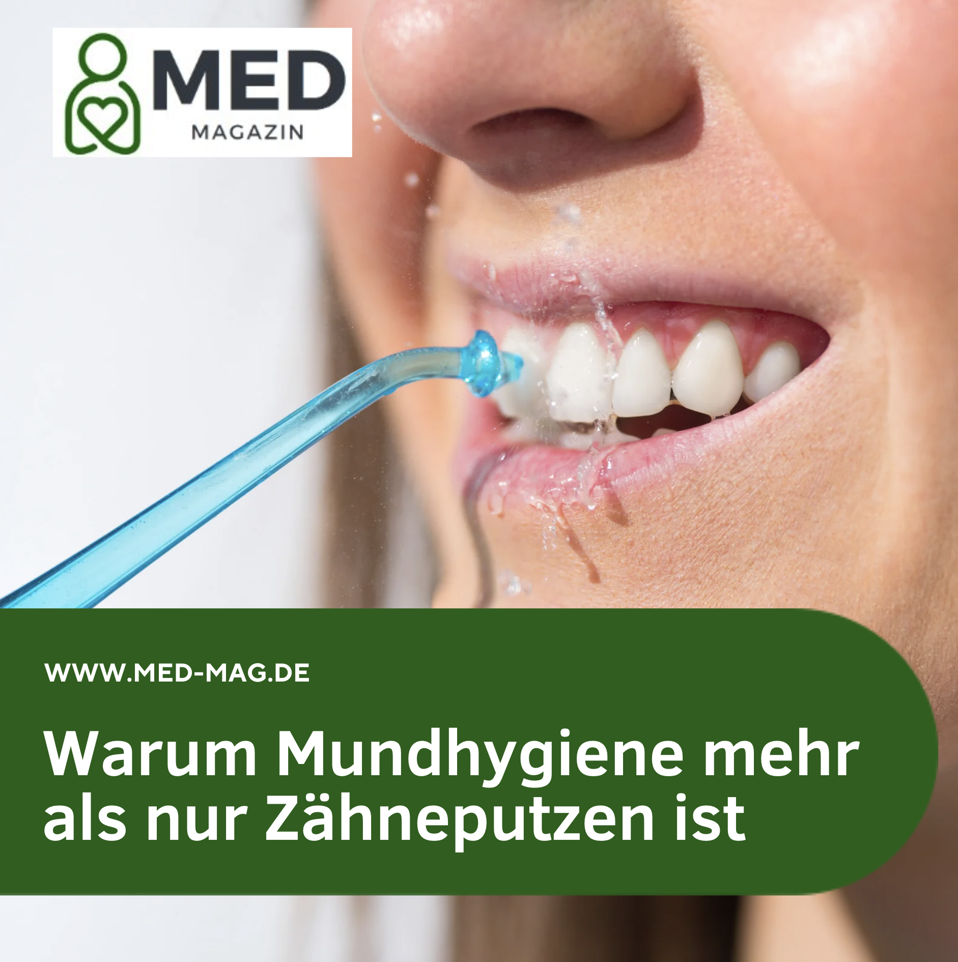 Warum Mundhygiene mehr als nur Zähneputzen ist Warum Mundhygiene mehr als nur Zähneputzen ist