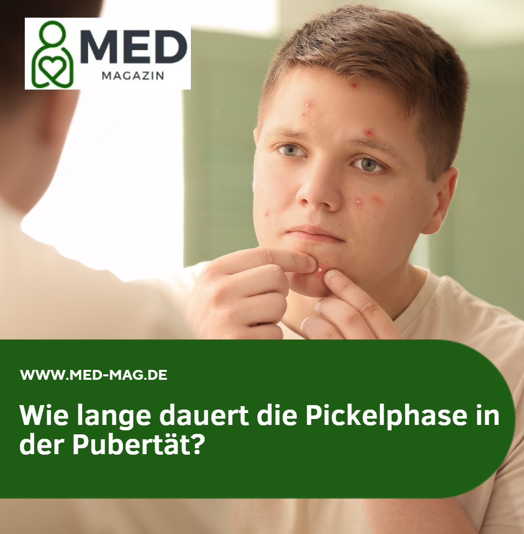 Wie lange dauert die Pickelphase in der Pubertät Wie lange dauert die Pickelphase in der Pubertät