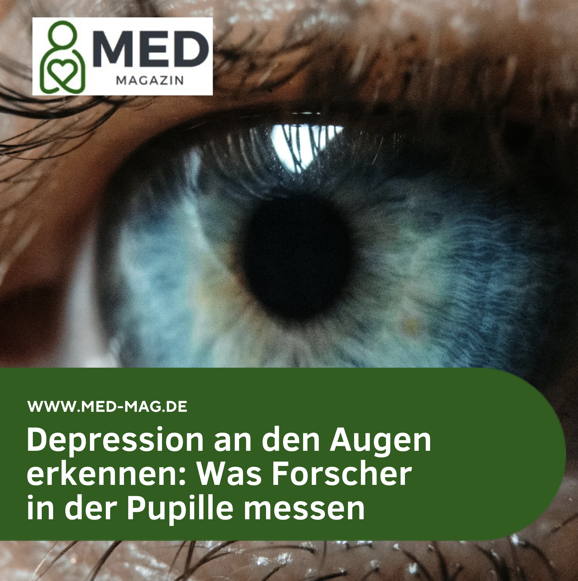 Depression an den Augen erkennen: Was Forscher in der Pupille messen Depression an den Augen erkennen: Was Forscher in der Pupille messen