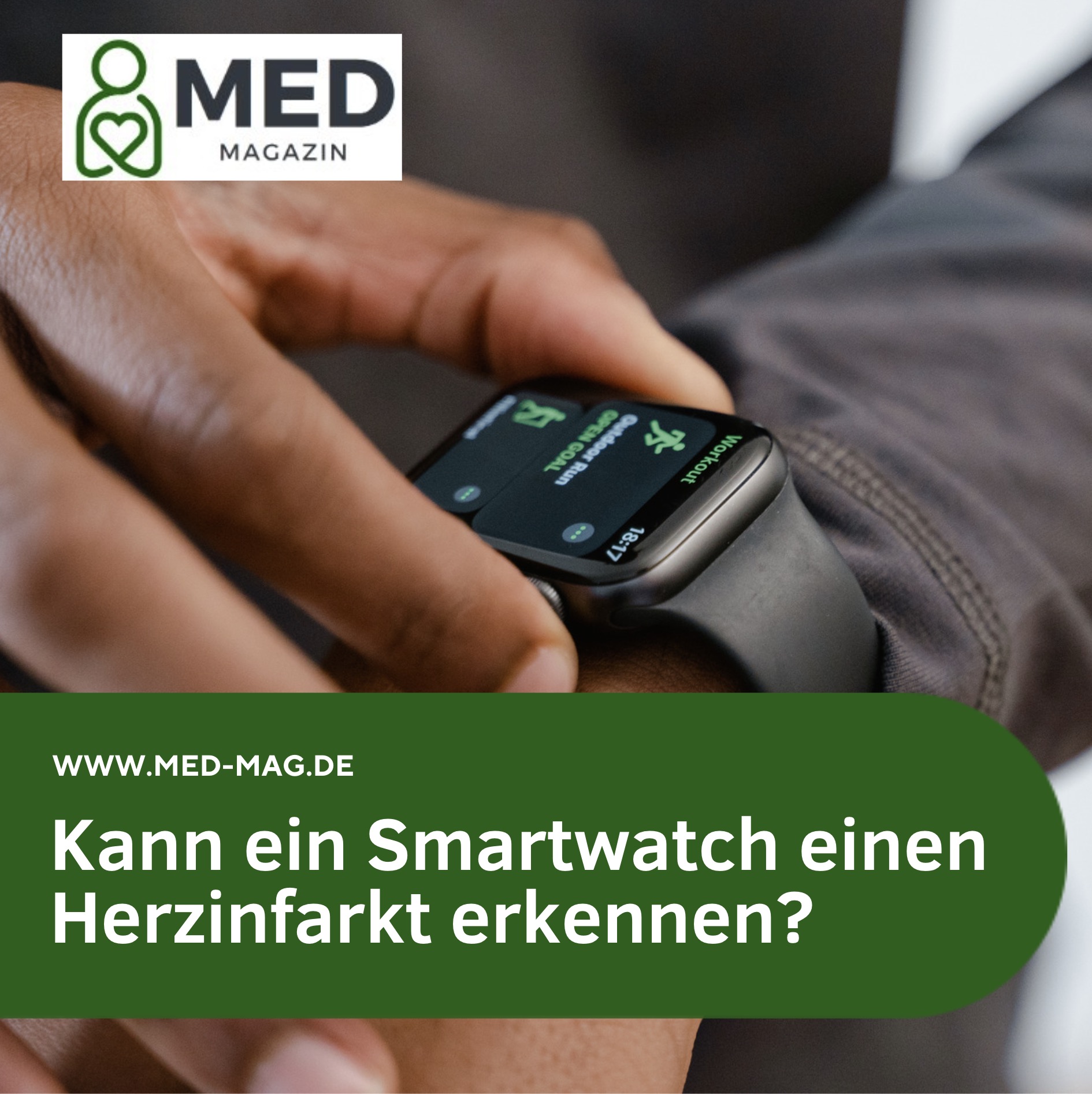 Kann ein Smartwatch einen Herzinfarkt erkennen? Kann ein Smartwatch einen Herzinfarkt erkennen?